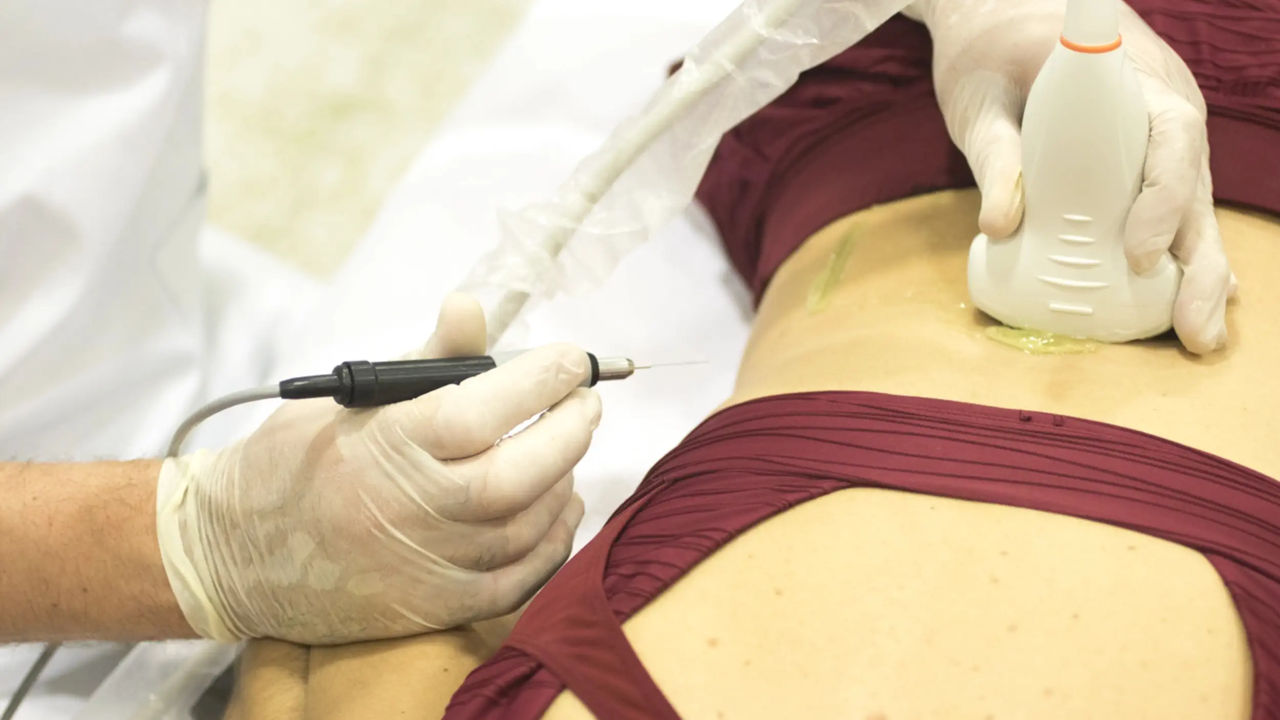 epi fisioterapia alicante